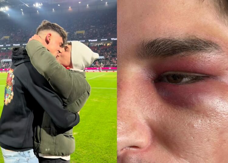 Pascal Kaiser victime d’une violente agression homophobe après sa demande en mariage sur le stade