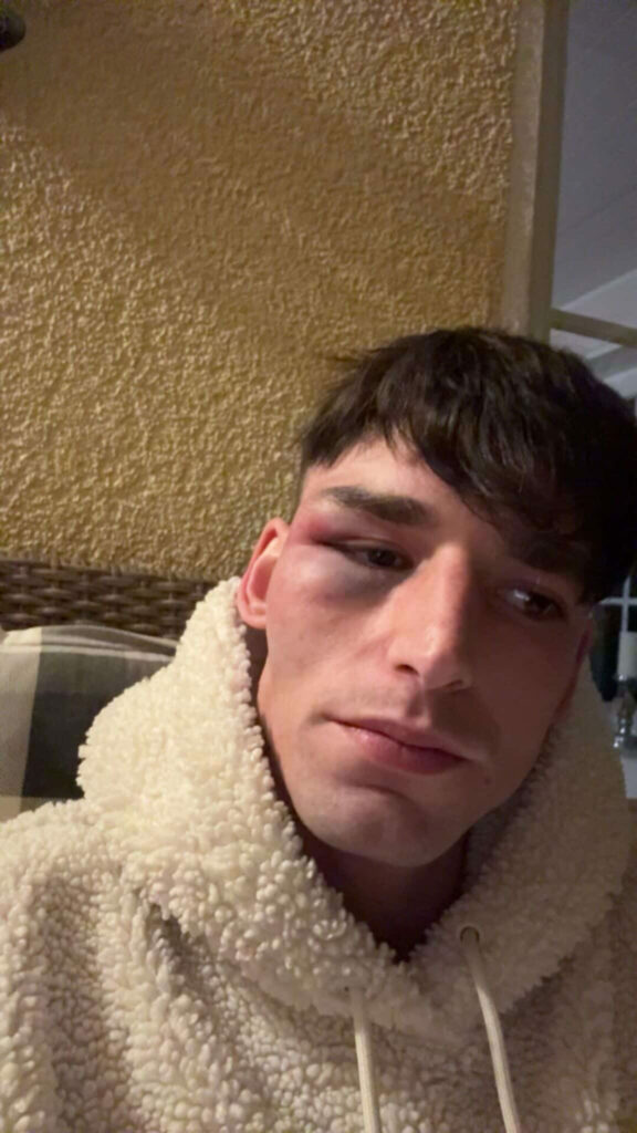 Pascal Kaiser victime d’une violente agression homophobe après sa demande en mariage sur le stade